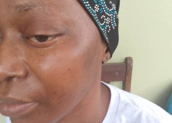 S.O.S POUR DAME KADIATOU CAMARA, AGEE DE 39 ANS QUI SOUFFRE DE MENINGIOME DU JUGUM