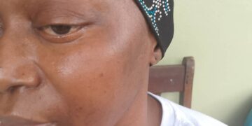 S.O.S POUR DAME KADIATOU CAMARA, AGEE DE 39 ANS QUI SOUFFRE DE MENINGIOME DU JUGUM